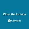 undefined ConvaTec - Close the Incision