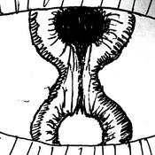 Podcast For Whom the Cell Tolls: Cancer Biology