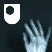 Podcast Rheumatoid arthritis - a long term condition - for iPod/iPhone