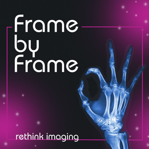 Listen to Frame by Frame: Rethink Imaging in the App